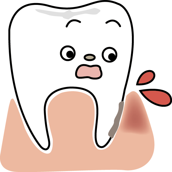 学校健診をきっかけにお口の健康チェックを