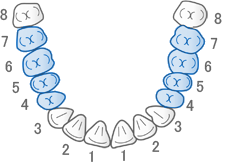 保険適用できる歯